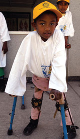 Rotary and the eradication of polio